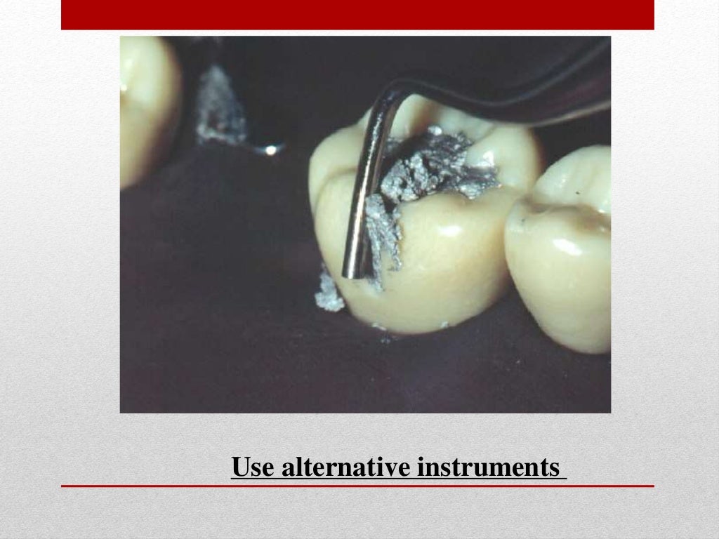 procedure for amalgam restoration