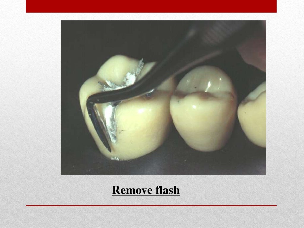 procedure for amalgam restoration
