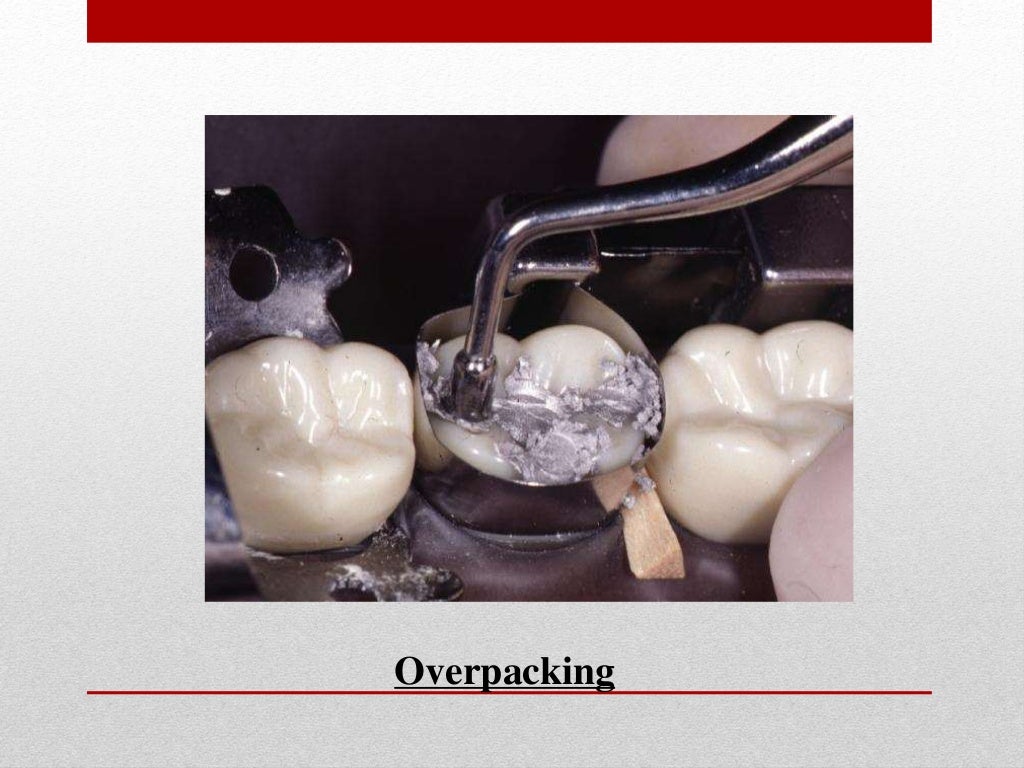 procedure for amalgam restoration