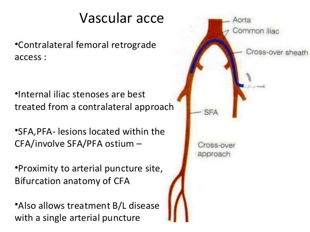 Endovascular Prep Basic endovascular-prep-basic