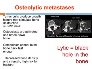 Osteolytic metastases
Tumor cells produce growth
factors that stimulate bone
destruction
•i.e. RANK ligand
Osteoclasts are activated
and break down
bone
Osteoblasts cannot build
bone back fast
enough
Decreased bone density
and strength; high risk for
fracture
Lytic = black
hole in the
bone
 