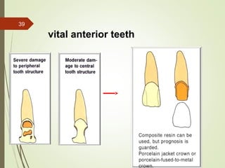 Managemant of Mutilated Vital Teeth presentation | PPT