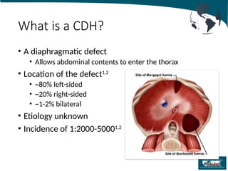 Comprehensive Management of Congenital Diaphragmatic Hernia in Neonates ...