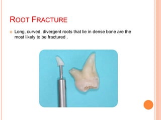 Management of-extraction-complications | PPSX