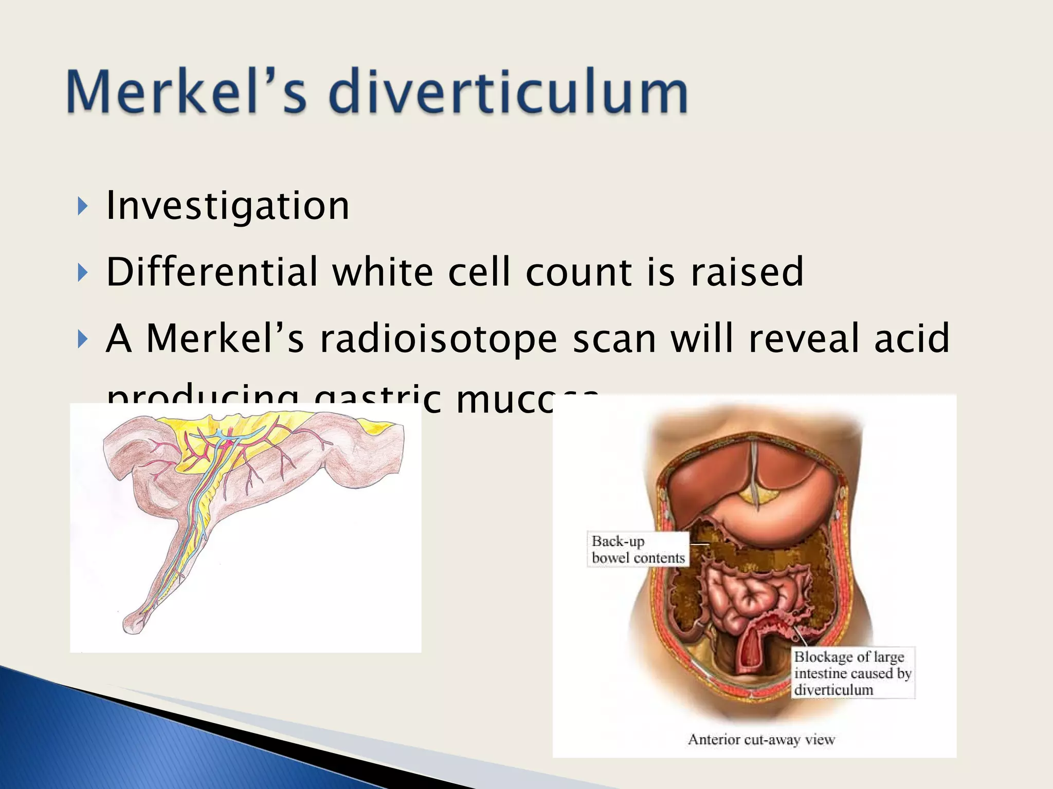 Investigation Differential white cell count is raised A Merkel’s radioisotope scan will reveal acid producing gastric mucosa.  