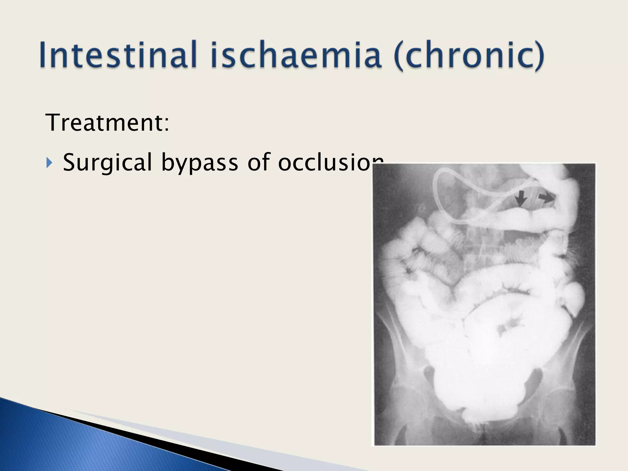 Treatment: Surgical bypass of occlusion.  
