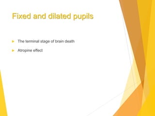 Fixed and dilated pupils
 The terminal stage of brain death
 Atropine effect
 