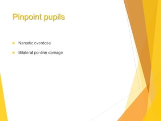 Pinpoint pupils
 Narcotic overdose
 Bilateral pontine damage
 