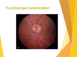 Fundoscopic examination
 