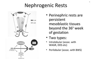 Management of-wilms-tumors-9306 - copy | PPT