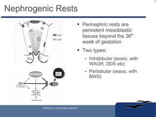 Management of Wilms Tumors | ODP