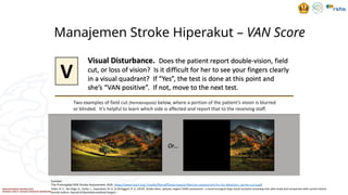 MANAGEMENT AND THERAPY ACUTE STROKE INFARK.pptx