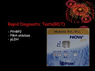 Rapid Diagnostic Tests(RDT)
- PfHRP2
- PMA-aldolase
- pLDH
 