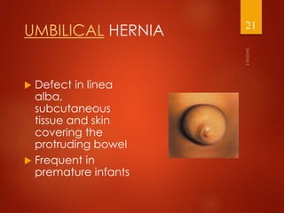 Management of abdominal wall defects | PPTX