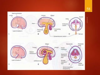 Management of abdominal wall defects | PPTX
