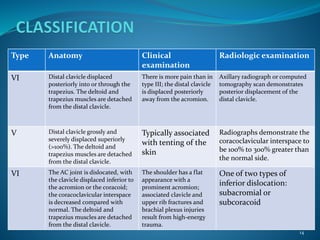 Management of acromioclavicular joint dislocations | PPTX