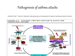 Management of acute asthma | PPTX
