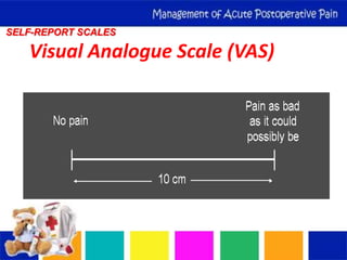 Management of acute postoperative pain r | PPTX