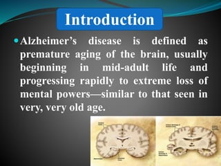 Recent advances in the management of alzheimers disease | PPTX