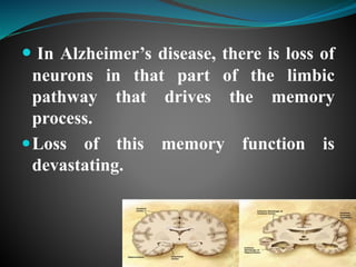 Recent advances in the management of alzheimers disease | PPTX