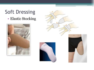 Emovable Rigid Dressing Management Of Amputation Stump.pptx