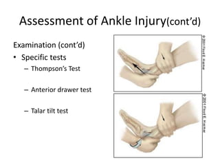 Talar Test Management of ankle injuries | PPTX