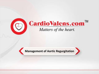 Management of Aortic Regurgitation
 