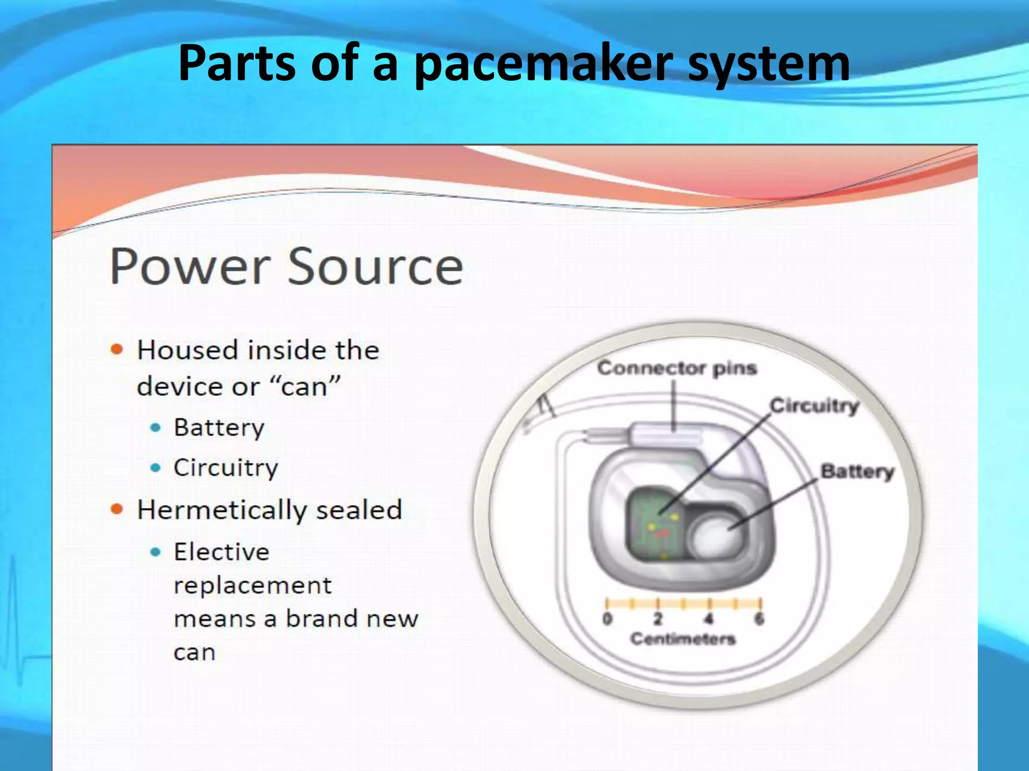 Parts of a pacemaker system
 