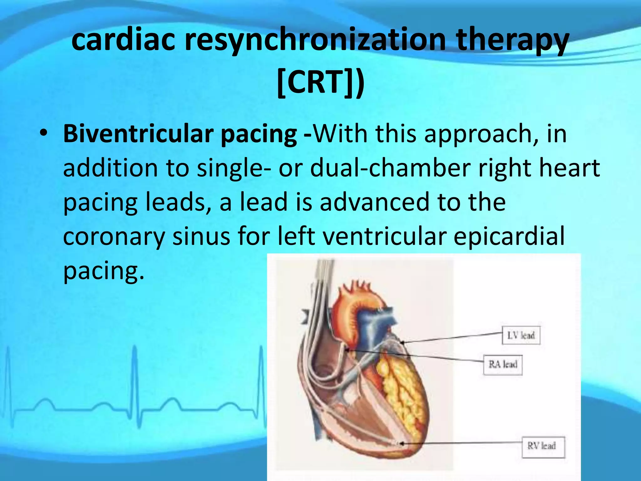 cardiac resynchronization therapy
[CRT])
• Biventricular pacing -With this approach, in
addition to single- or dual-chamber right heart
pacing leads, a lead is advanced to the
coronary sinus for left ventricular epicardial
pacing.
 
