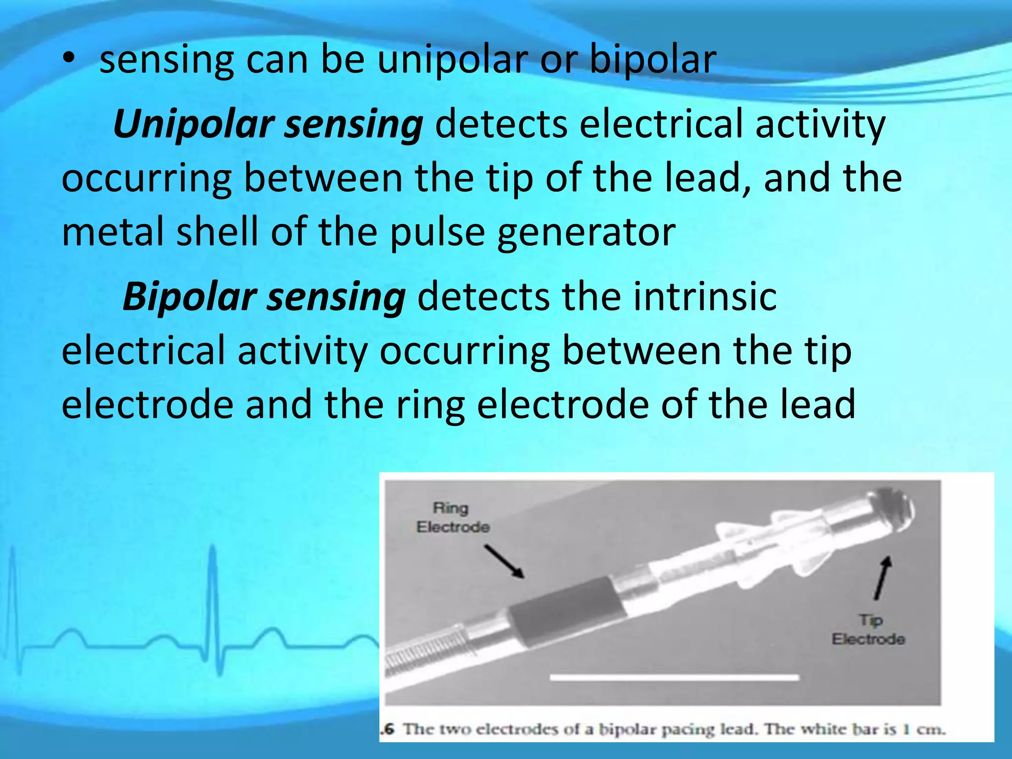 • sensing can be unipolar or bipolar
Unipolar sensing detects electrical activity
occurring between the tip of the lead, and the
metal shell of the pulse generator
Bipolar sensing detects the intrinsic
electrical activity occurring between the tip
electrode and the ring electrode of the lead
 