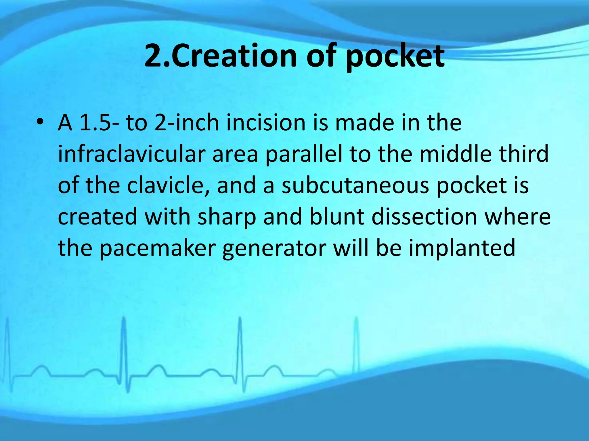 2.Creation of pocket
• A 1.5- to 2-inch incision is made in the
infraclavicular area parallel to the middle third
of the clavicle, and a subcutaneous pocket is
created with sharp and blunt dissection where
the pacemaker generator will be implanted
 