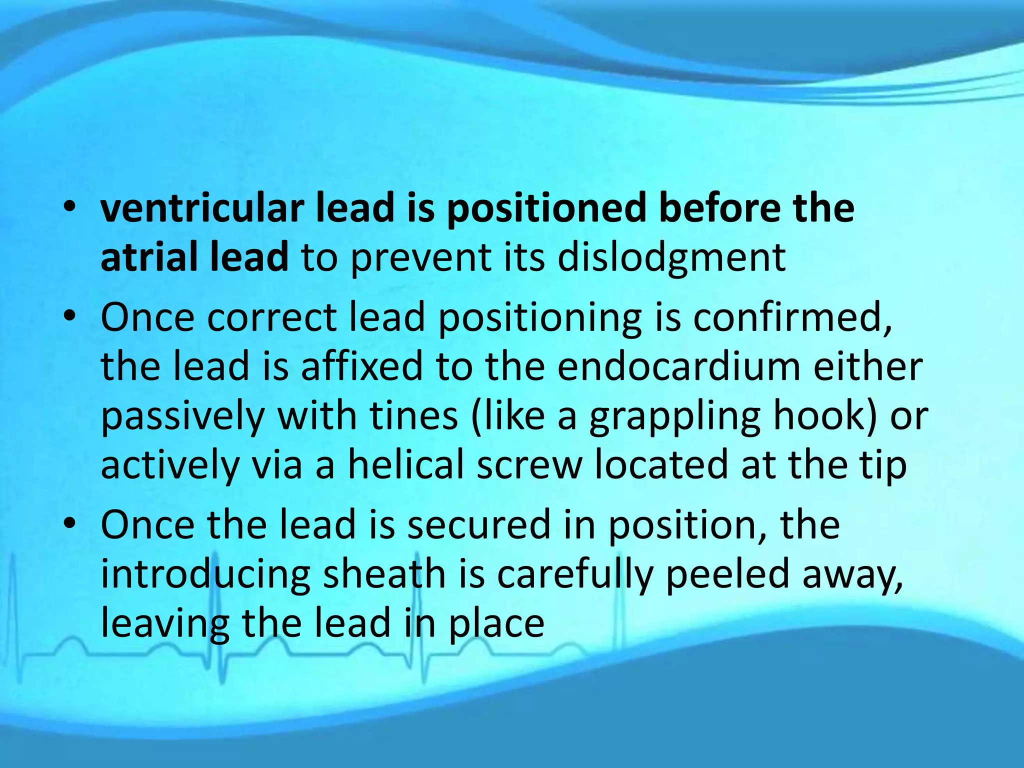 • ventricular lead is positioned before the
atrial lead to prevent its dislodgment
• Once correct lead positioning is confirmed,
the lead is affixed to the endocardium either
passively with tines (like a grappling hook) or
actively via a helical screw located at the tip
• Once the lead is secured in position, the
introducing sheath is carefully peeled away,
leaving the lead in place
 