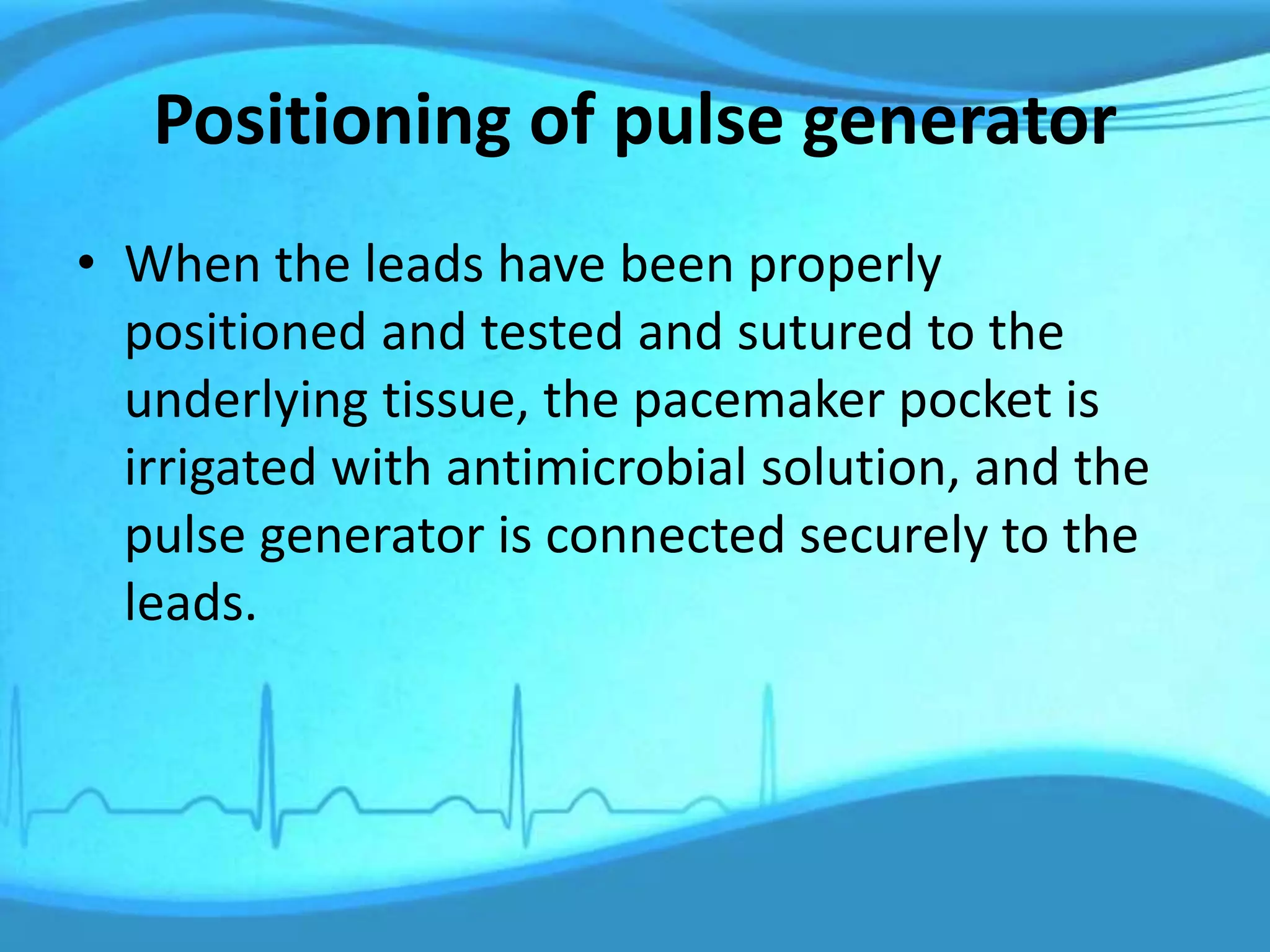 Positioning of pulse generator
• When the leads have been properly
positioned and tested and sutured to the
underlying tissue, the pacemaker pocket is
irrigated with antimicrobial solution, and the
pulse generator is connected securely to the
leads.
 