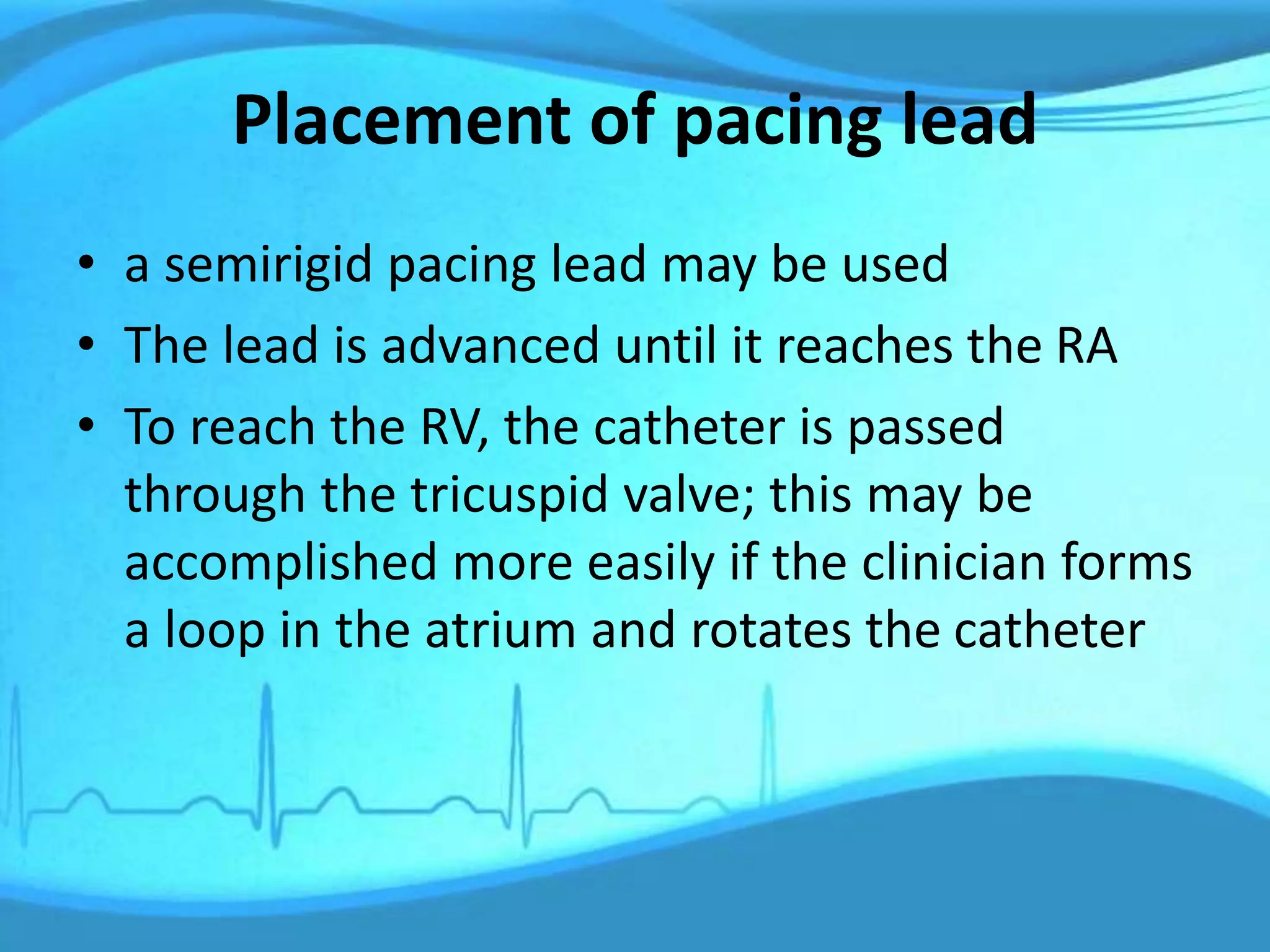 Placement of pacing lead
• a semirigid pacing lead may be used
• The lead is advanced until it reaches the RA
• To reach the RV, the catheter is passed
through the tricuspid valve; this may be
accomplished more easily if the clinician forms
a loop in the atrium and rotates the catheter
 