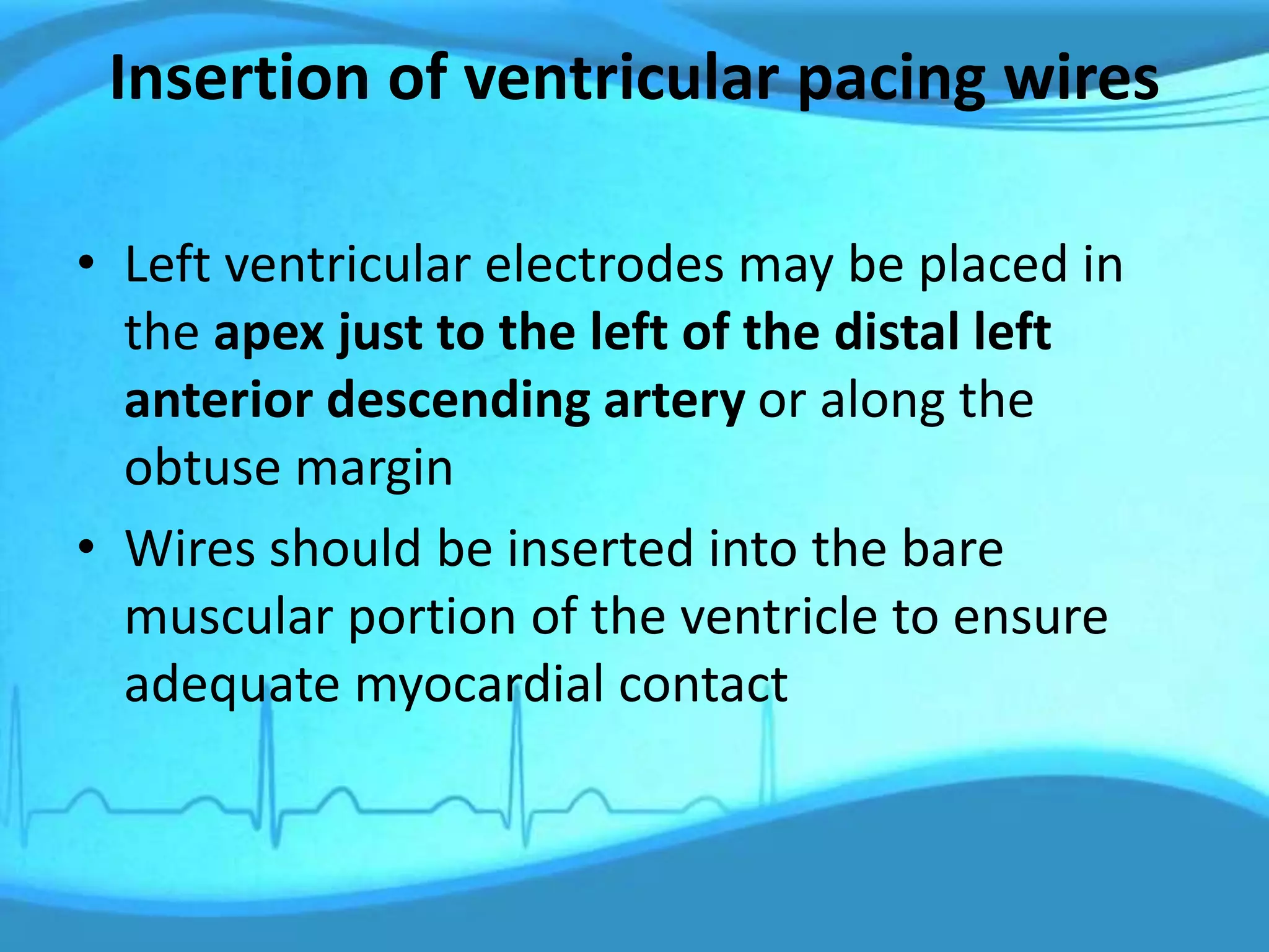 Insertion of ventricular pacing wires
• Left ventricular electrodes may be placed in
the apex just to the left of the distal left
anterior descending artery or along the
obtuse margin
• Wires should be inserted into the bare
muscular portion of the ventricle to ensure
adequate myocardial contact
 