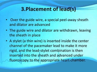 Management of a patient with pacemaker | PPTX
