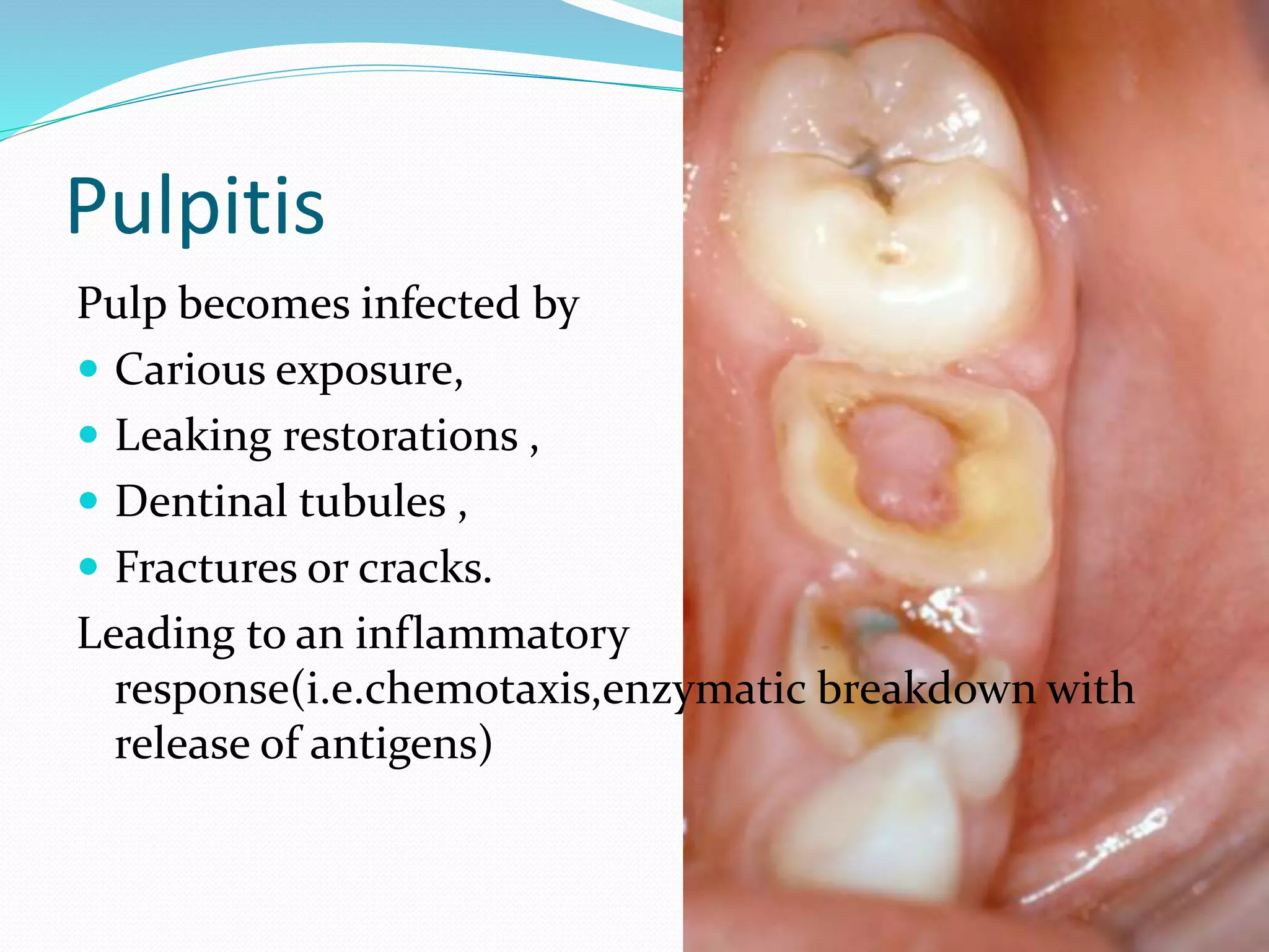 Management of apical lesions
