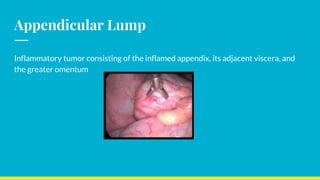 Appendicular Lump
Inflammatory tumor consisting of the inflamed appendix, its adjacent viscera, and
the greater omentum
 