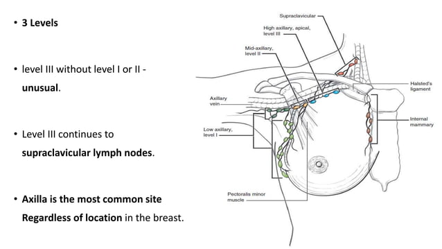 Management of axilla in carcinoma breast | PPTX
