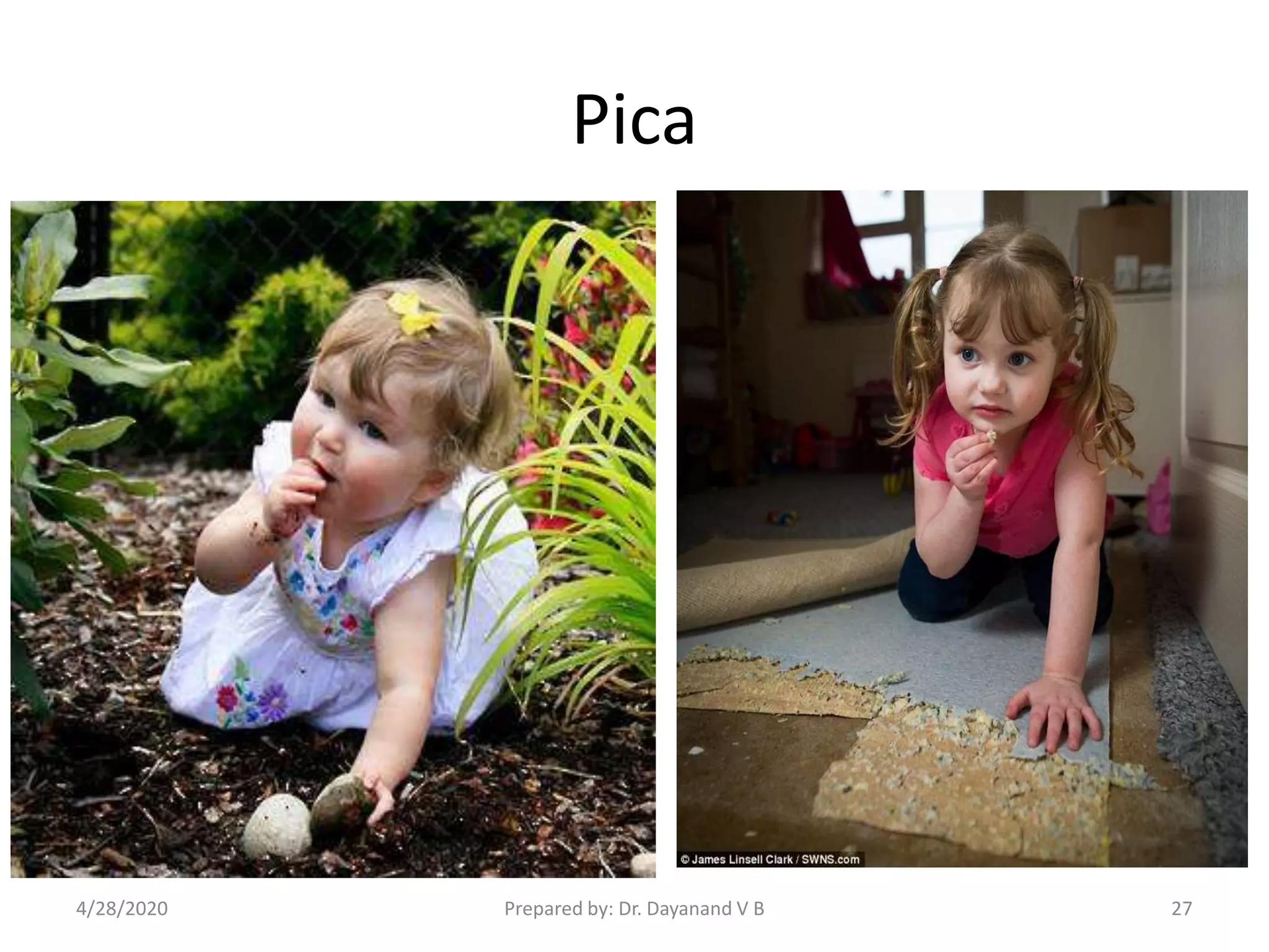 Pica
Prepared by: Dr. Dayanand V B4/28/2020 27
 