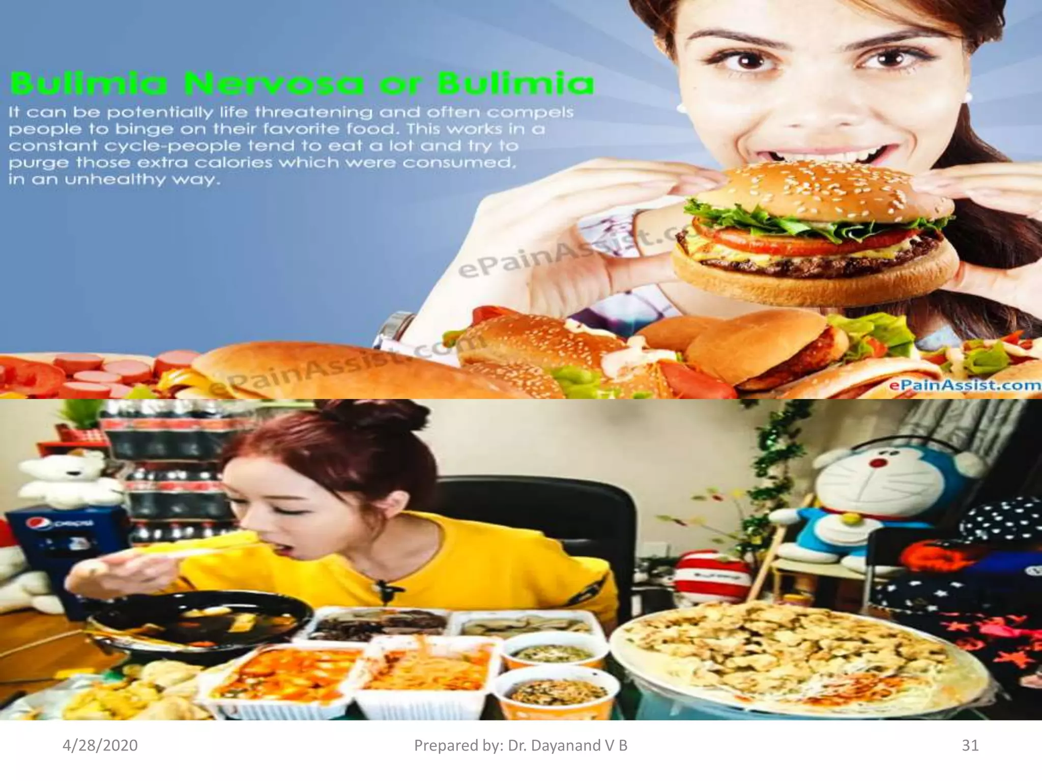 Prepared by: Dr. Dayanand V B4/28/2020 31
 