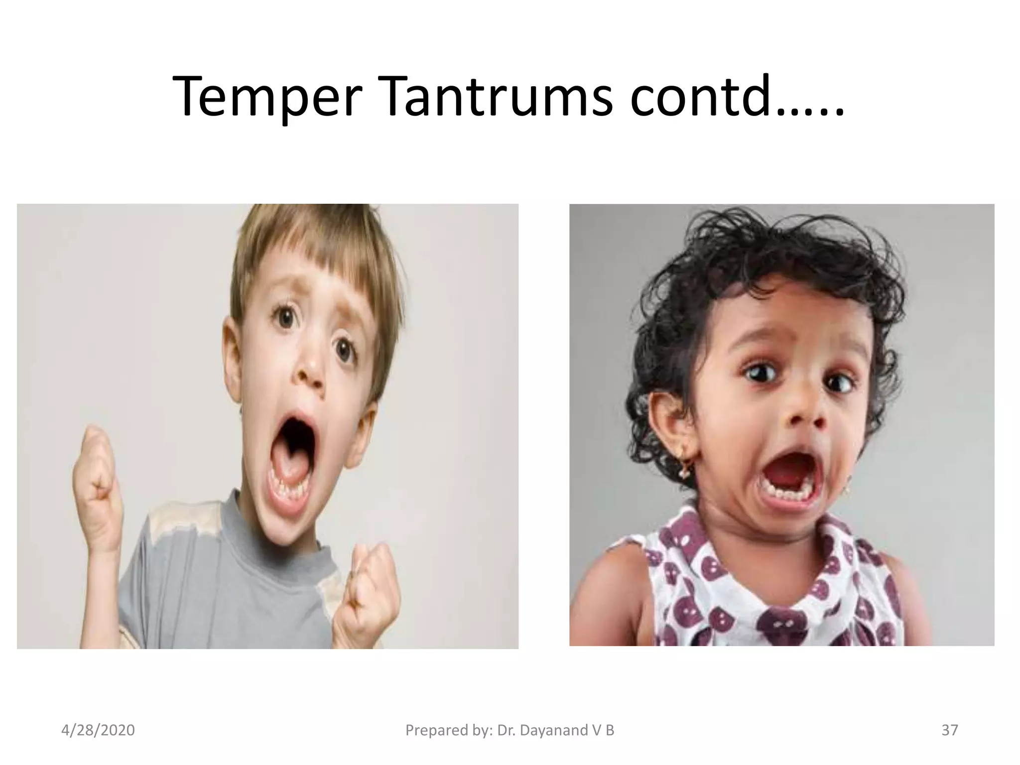 Temper Tantrums contd…..
Prepared by: Dr. Dayanand V B4/28/2020 37
 