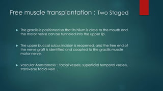 Management of bells palsy | PPTX