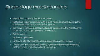 Management of bells palsy | PPTX