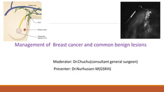 Management of Breast cancer and common benign lesions
Moderator: Dr.Chuchu(consultant general surgeon)
Presenter: Dr.Nurhussen M(GSRIII)
 