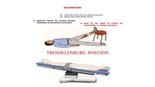 TRENDELENBURG POSITION
 