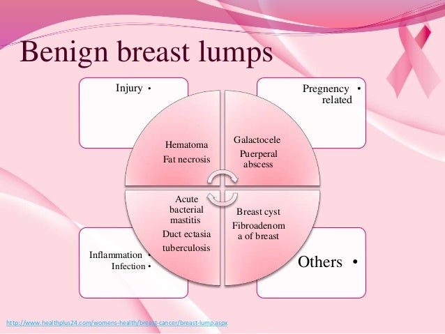 Breast Lumps Types 100