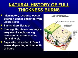 Eschar Examples MANAGEMENT OF BURNS with Classifications | PPT