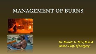 MANAGEMENT OF BURNS
Dr. Murali. U. M.S; M.B.A
Assoc. Prof. of Surgery
 