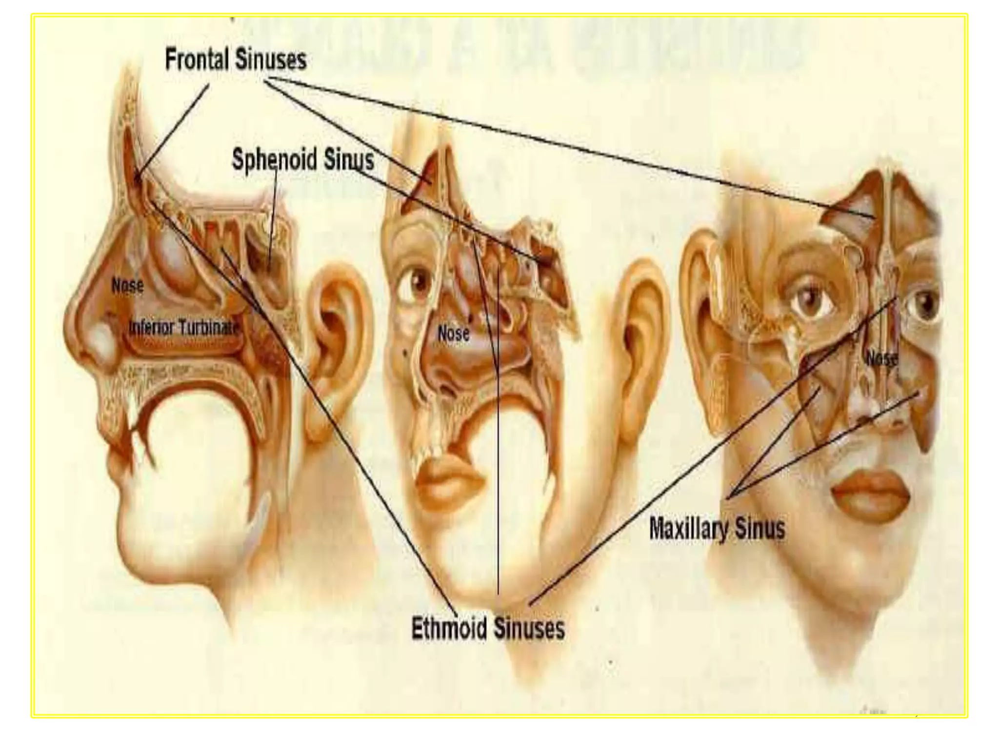 Management of ca maxillary sinus | PPTX